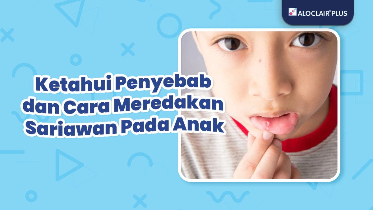 10 Rekomendasi Obat Sariawan untuk Dewasa dan Anak-anak